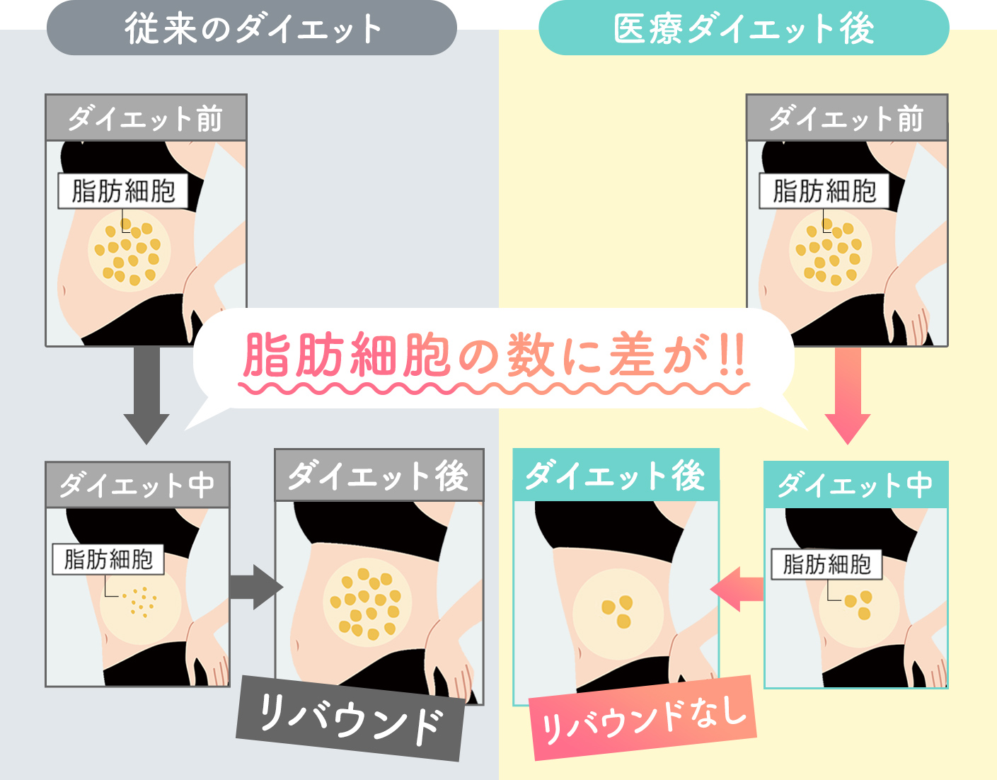 従来のダイエット：リバウンド 医療ダイエット：リバウンドなし 脂肪細胞の数に差が！