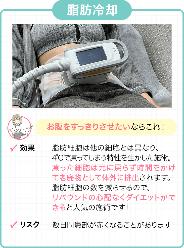 脂肪冷却