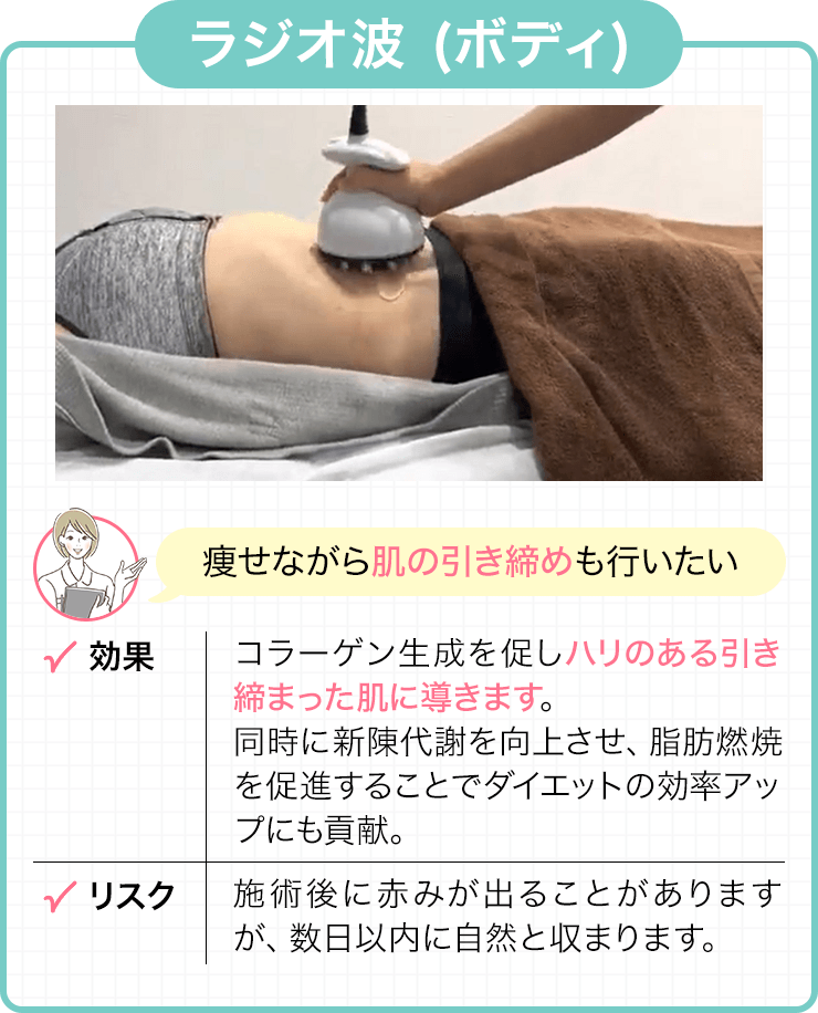 ラジオ波 (ボディ)