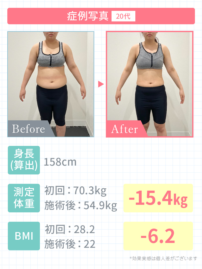 実績1