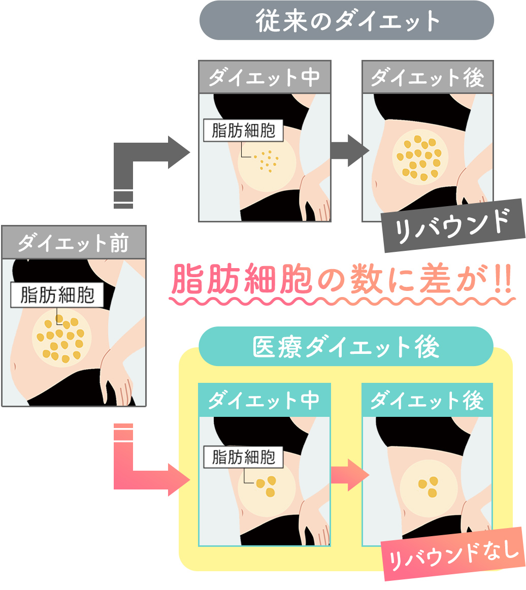 従来のダイエット：リバウンド 医療ダイエット：リバウンドなし 脂肪細胞の数に差が！